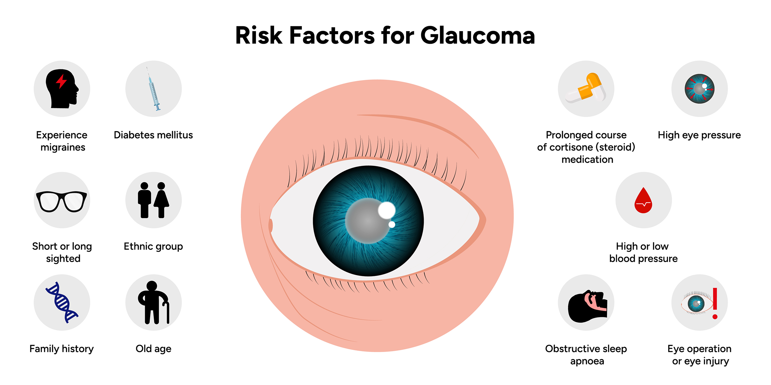 Glaucoma risk factors Glaucoma risk factors