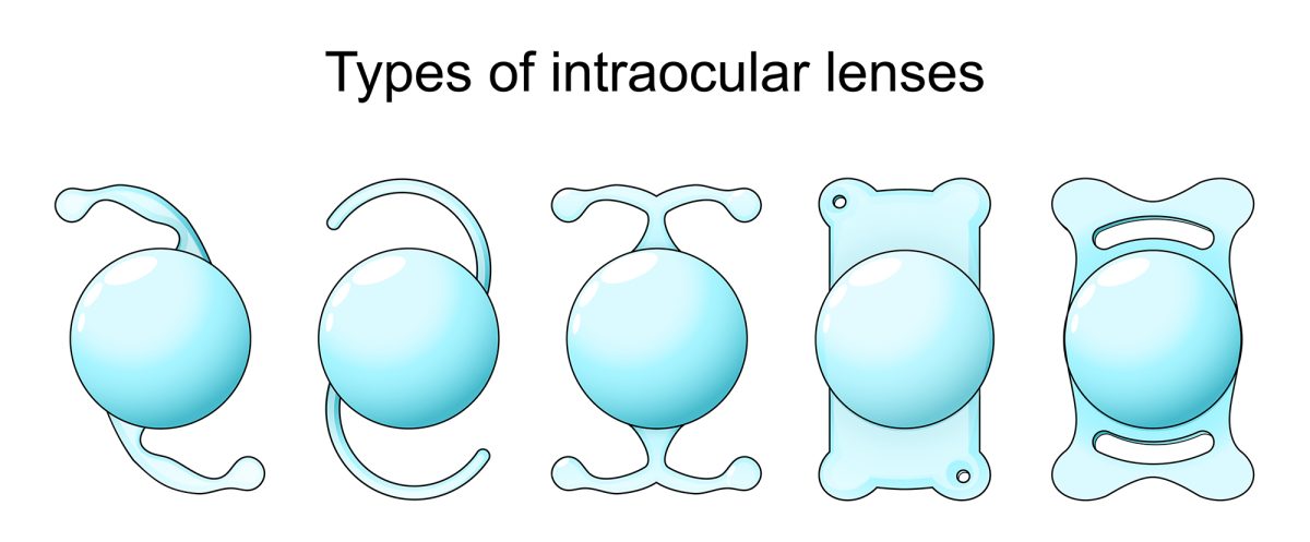 Types of Intraocular lenses
